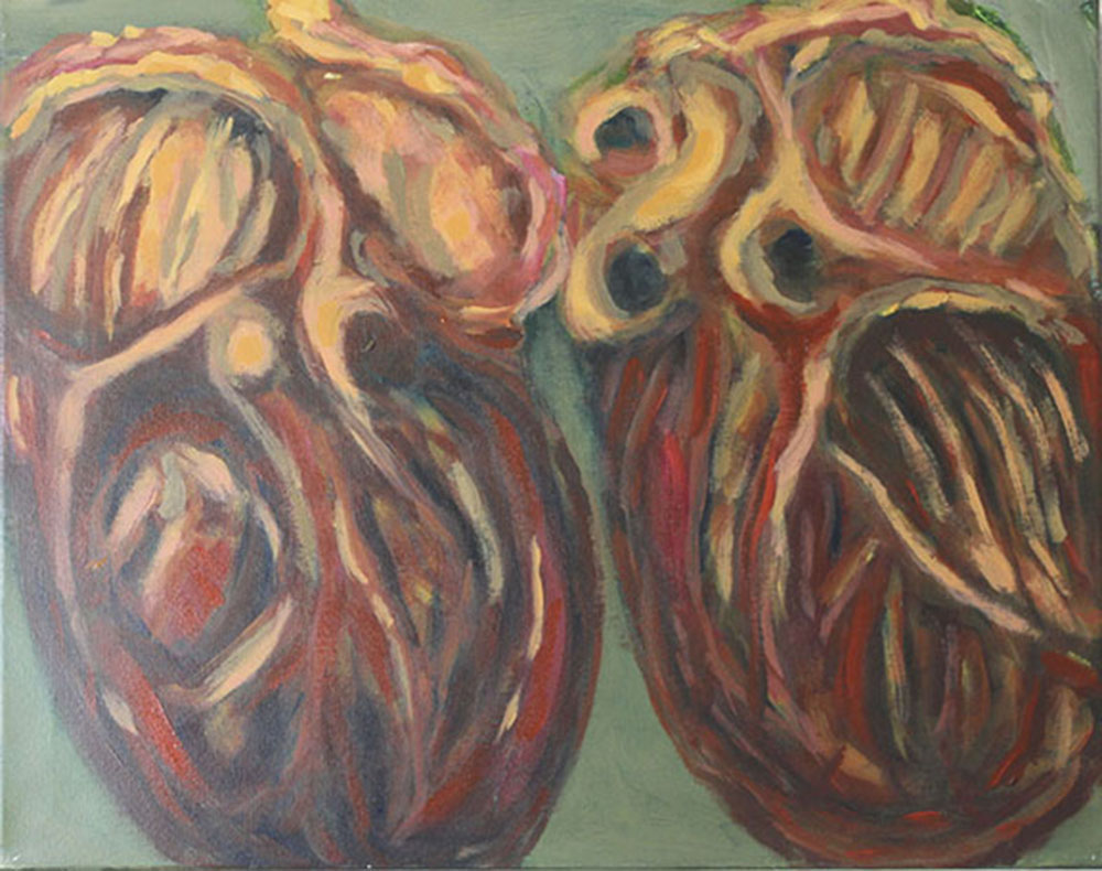 Helen Ohara - My Broken Heart - acrylic on canvas