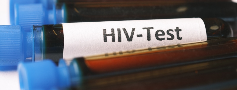 medical HIV tests