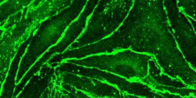 Muscle labeled with GFP visualized on multiphoton