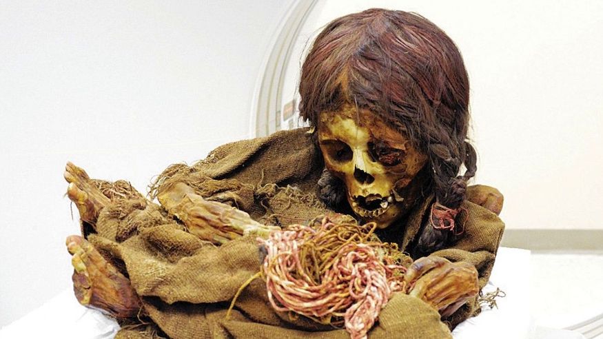 A photo of the Inca mummy being studied. 